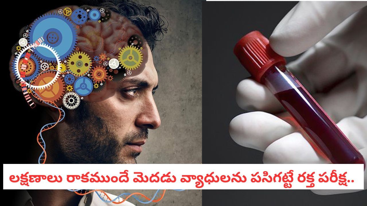 Brain Health: ఈ టెస్టు పాజిటివ్ తేలితే.. లక్షణాలు లేకున్నా మీకు ఆ రెండు వ్యాధుల రిస్క్ తప్పదు..!