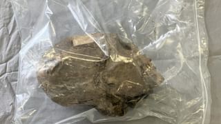 Viral: అక్కడెలా పెట్టుకున్నావురా.. 10 ఏళ్ల బాలుడికి ఎక్స్‌రే తీసి బిత్తరపోయిన డాక్టర్లు