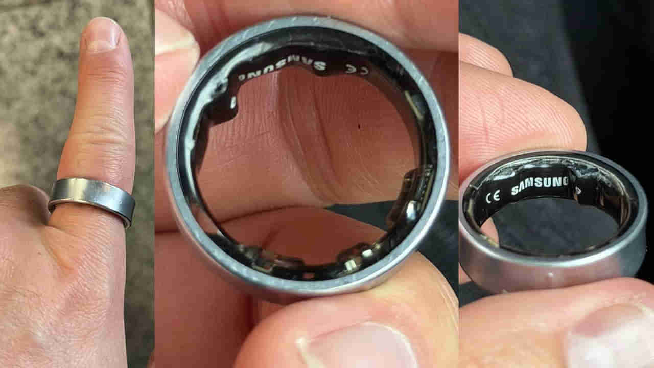 Smart Ring: వామ్మో.. స్మార్ట్‌ రింక్‌ ఇంత డేంజరా? ధరిస్తున్న వారు తప్పక తెలుసుకోవాల్సిందే..