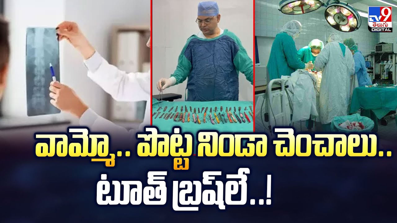 వామ్మో..పొట్ట నిండా చెంచాలు..టూత్‌ బ్రష్‌లే..