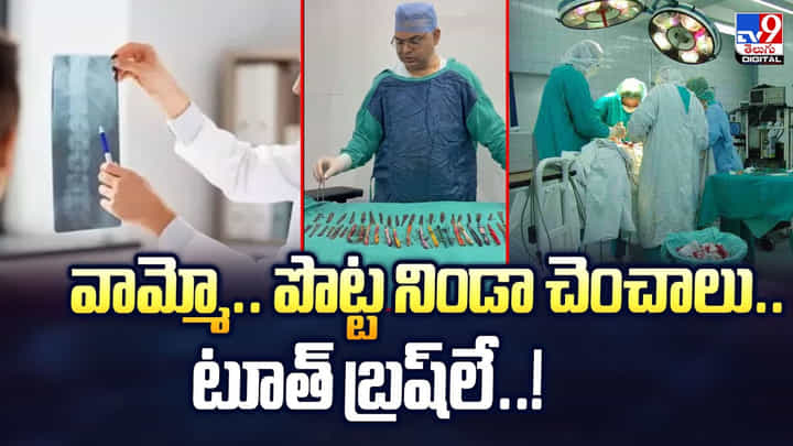 వామ్మో..పొట్ట నిండా చెంచాలు..టూత్ బ్రష్లే.. వామ్మో..పొట్ట నిండా చెంచాలు..టూత్ బ్రష్లే..