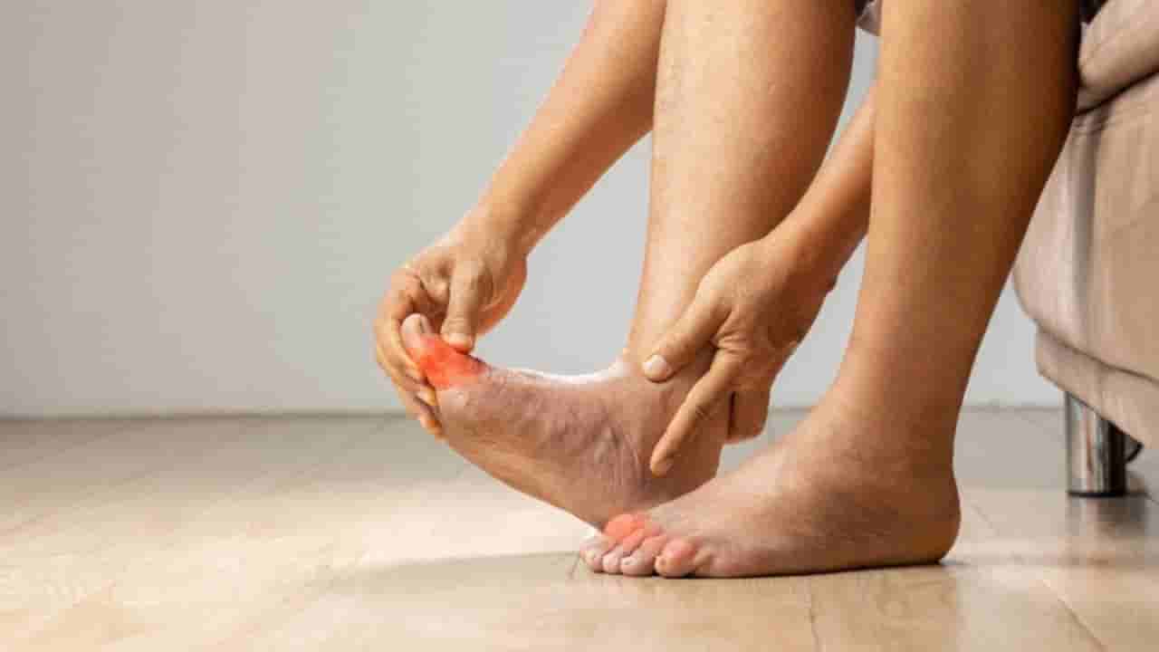 యూరిక్ యాసిడ్.. ఈ లక్షణాలు కనిపిస్తే అస్సలు నిర్లక్ష్యం చేయొద్దు..!