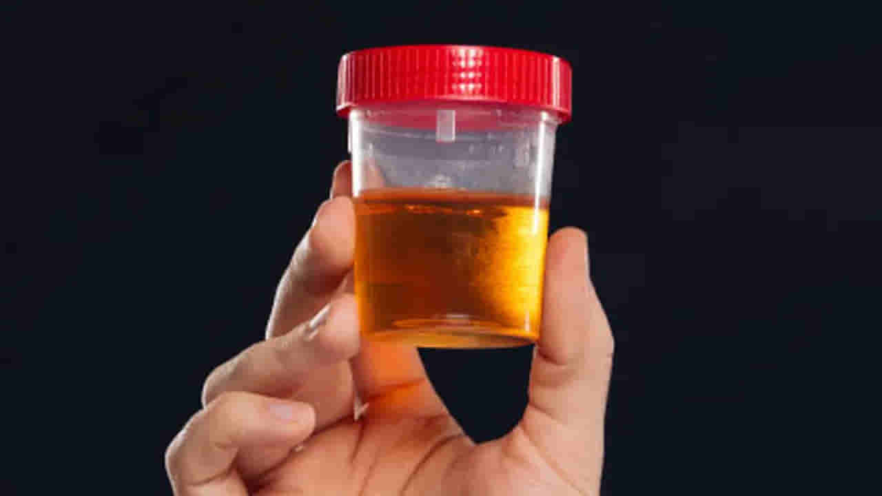 ఓర్నాయనో.. మూత్రం వాసన వస్తుందా..? ఈ తీవ్రమైన వ్యాధులకు సంకేతం కావొచ్చు..