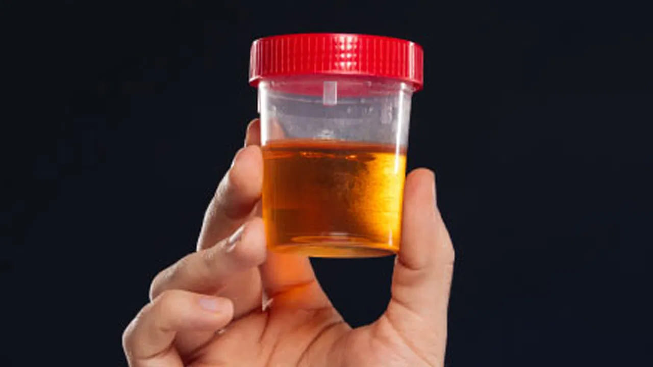 ఓర్నాయనో.. మూత్రం వాసన వస్తుందా..? ఈ తీవ్రమైన వ్యాధులకు సంకేతం కావొచ్చు..