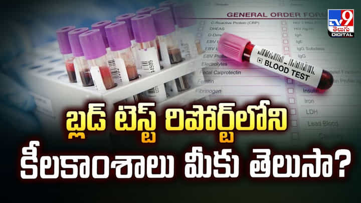 బ్లడ్ టెస్ట్ రిపోర్ట్లోని కీలకాంశాలు మీకు తెలుసా? వీడియో బ్లడ్ టెస్ట్ రిపోర్ట్లోని కీలకాంశాలు మీకు తెలుసా? వీడియో