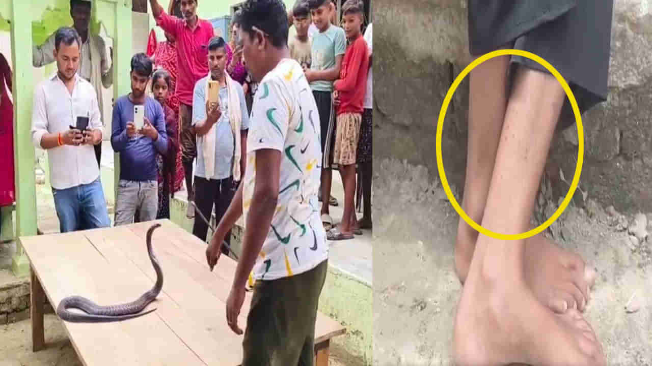 15ఏళ్ల బాలికపై పగబట్టిన పాము.. ఇంట్లో తిష్టవేసి 40 రోజుల్లో 12 సార్లు కాటు.. చివరికి ఏం చేశారంటే..