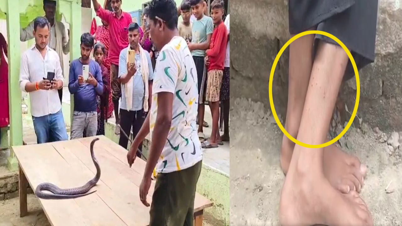 15ఏళ్ల బాలికపై పగబట్టిన పాము.. ఇంట్లో తిష్టవేసి 40 రోజుల్లో 12 సార్లు కాటు.. చివరికి ఏం చేశారంటే..