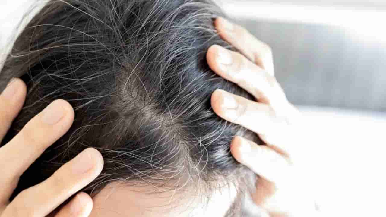 White Hair: యువతలో పెరుగుతున్న తెల్ల జుట్టు సమస్య.. నల్లగా మారడానికి ఏం తినాలో తెలుసా..?