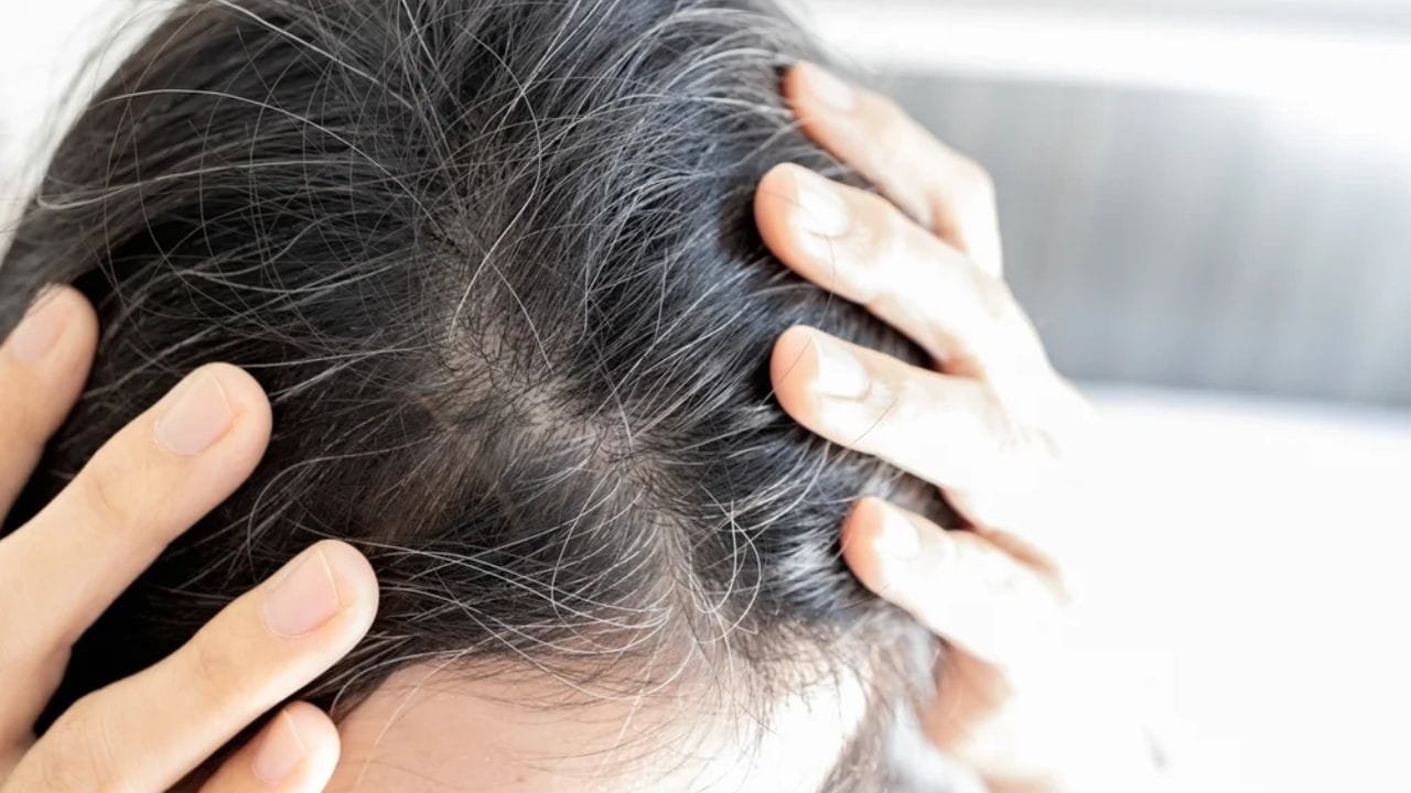 White Hair: యువతలో పెరుగుతున్న తెల్ల జుట్టు సమస్య.. నల్లగా మారడానికి ఏం తినాలో తెలుసా..?