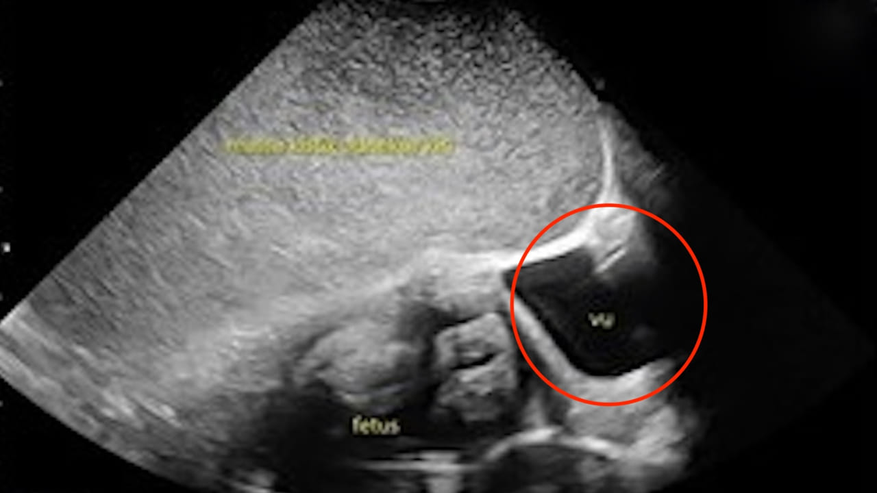 Viral: పురిటి నొప్పులతో అస్పత్రికొచ్చిన గర్భవతి.. కడుపులో ఉన్న పిండం ఎక్స్‌రే తీయగా