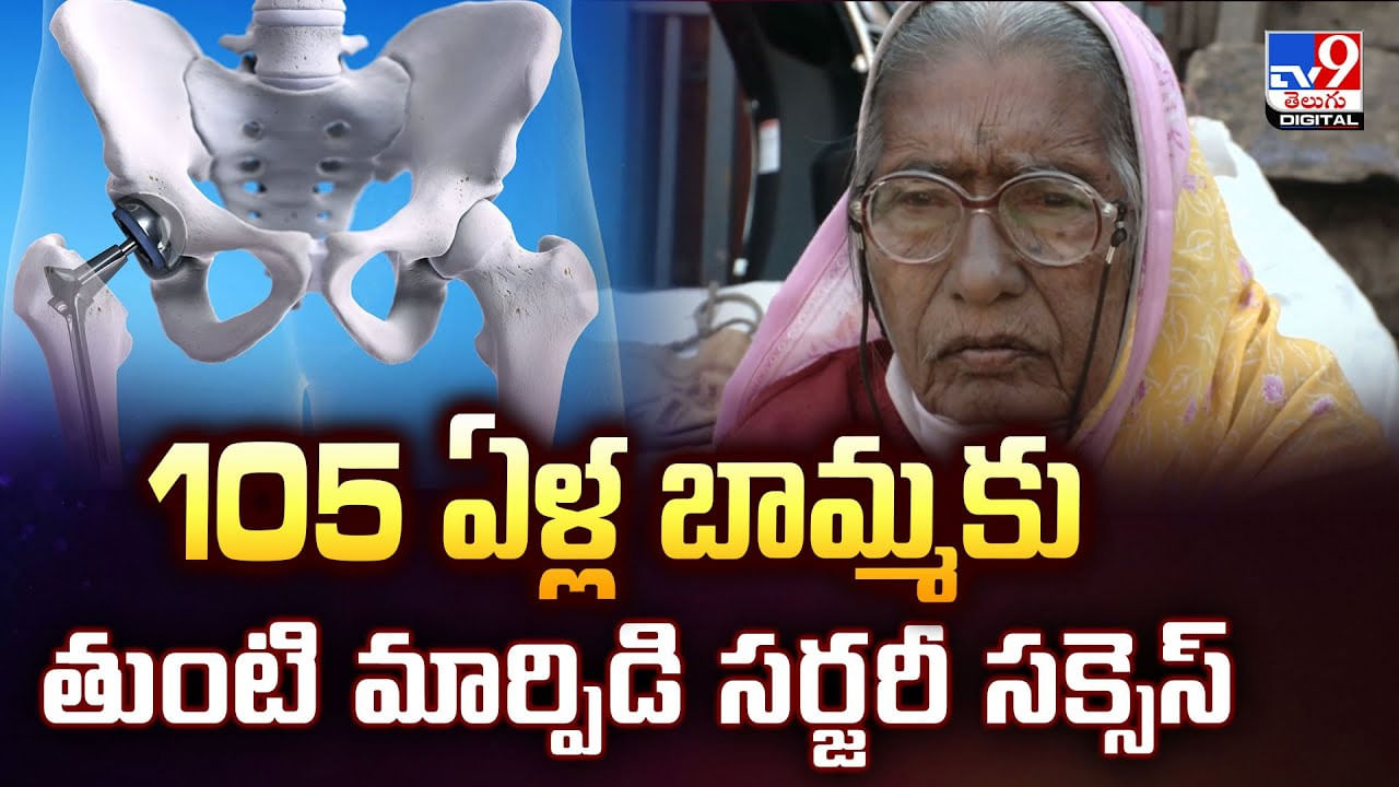 105 ఏళ్ల బామ్మకు తుంటి మార్పిడి సర్జరీ సక్సెస్‌ వీడియో
