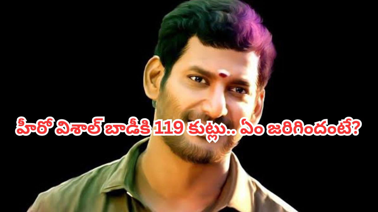 Actor Vishal: హీరో విశాల్ బాడీకి 119 కుట్లు.. ఏం జరిగిందంటే?