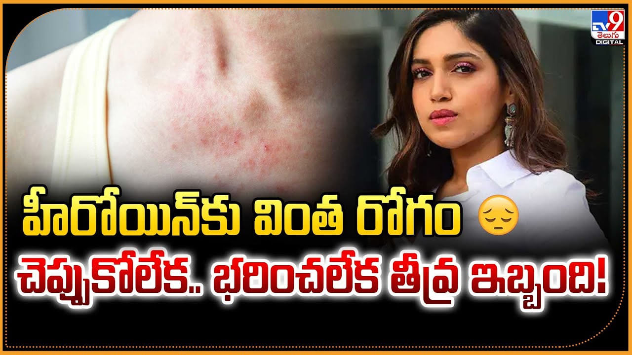 హీరోయిన్‌కు వింత రోగం.. చెప్పుకోలేక.. భరించలేక తీవ్ర ఇబ్బంది