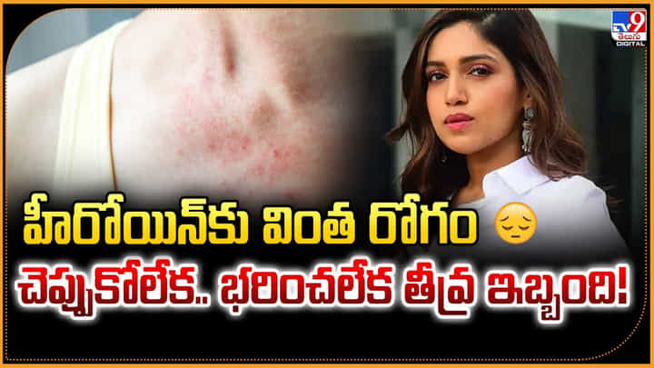 హీరోయిన్కు వింత రోగం.. చెప్పుకోలేక.. భరించలేక తీవ్ర ఇబ్బంది హీరోయిన్కు వింత రోగం.. చెప్పుకోలేక.. భరించలేక తీవ్ర ఇబ్బంది