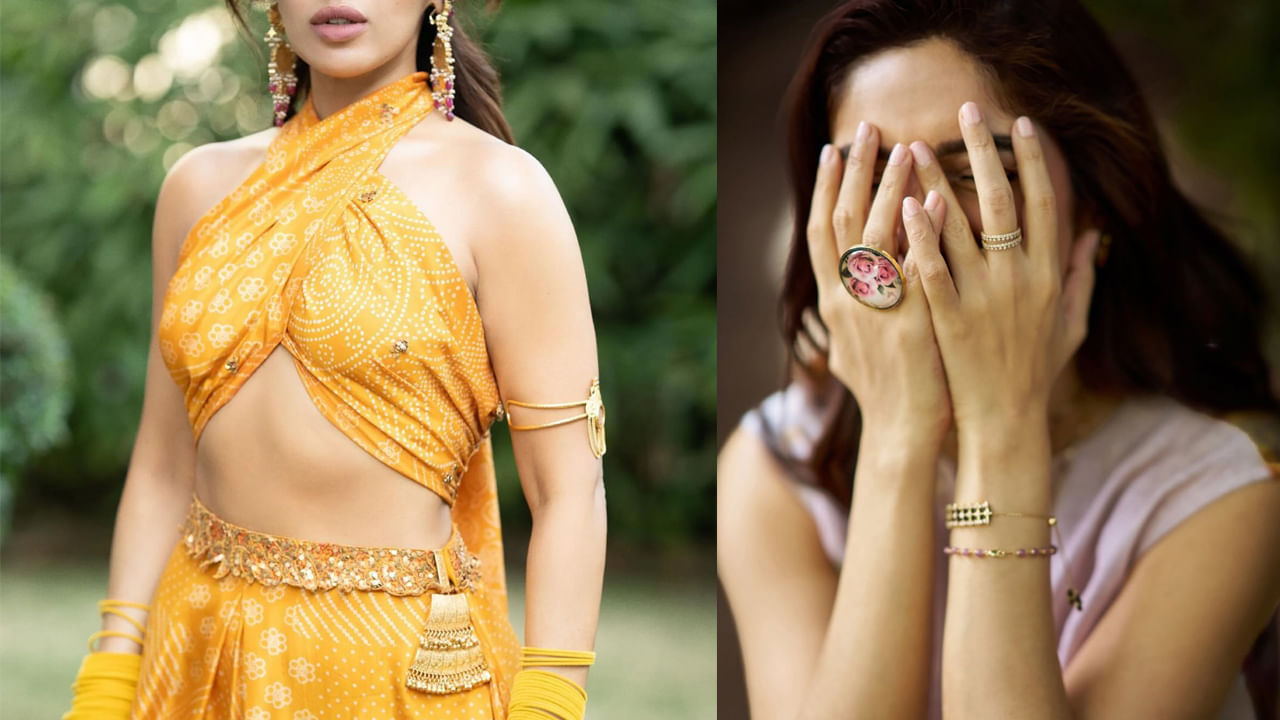 Tollywood: అరే.. ఈ అందాల తారకు ఎంత కష్టమొచ్చింది! అరుదైన చర్మ సమస్యతో బాధపడుతోన్న స్టార్ హీరోయిన్