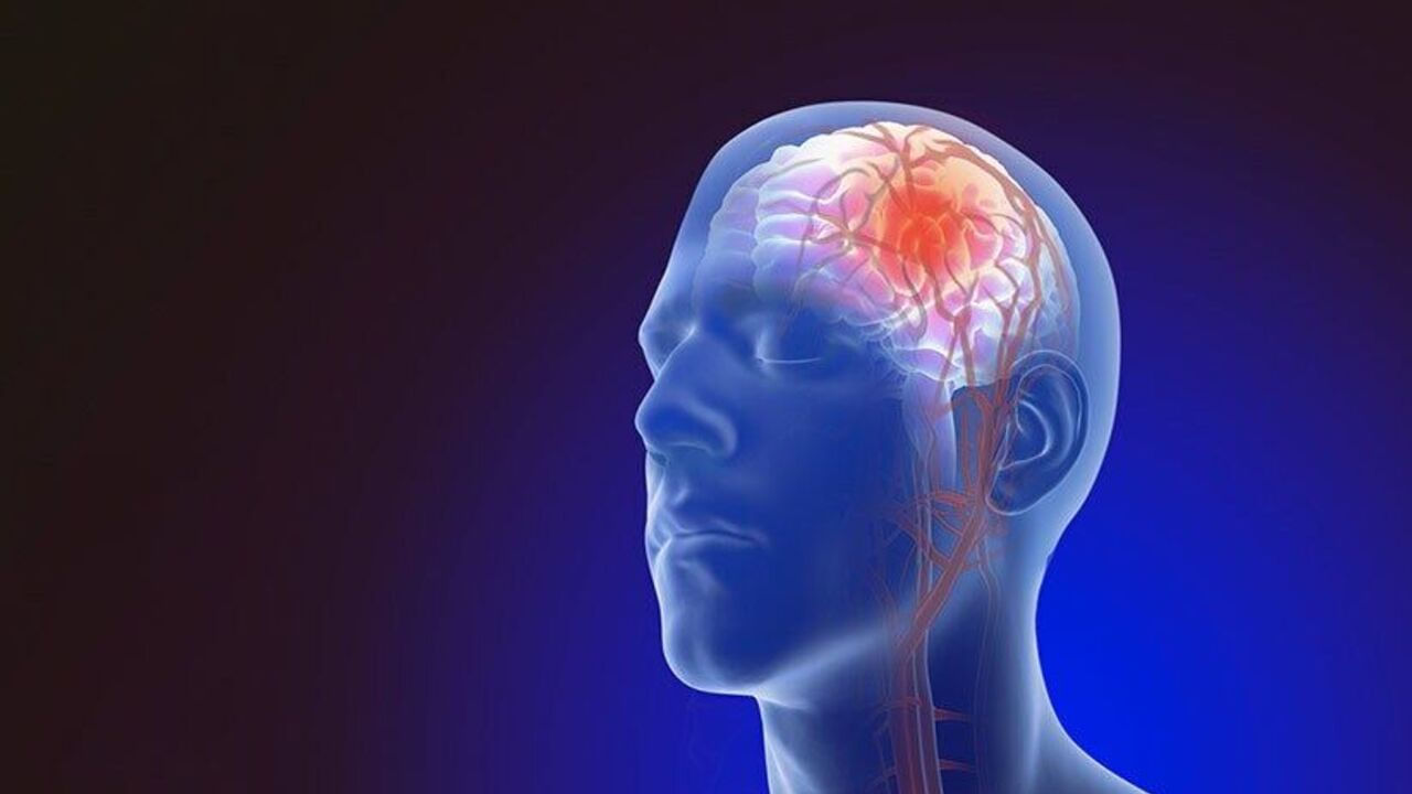 ఇక ఈ మధ్య వయసుతో సంబంధం లేకుండా చాలా మంది బ్రెయిన్ స్ట్రోక్ బారినపడుతున్నారు. చిన్న వారిలో కూడా ఈ స్ట్రోక్ కేసులు అనేవి విపరీతంగా పెరుగుతున్నాయి. దాదాపు నలుగురిలో 50 సంవత్సరాల కంటే తక్కువ ఉన్నవారే స్ట్రోక్ బారినపడుతున్నారు. దీనికి కారణం శారీరక శ్రమ లేకపోవడం, జీవనశైలి కారణం అని చెబుతున్నారు వైద్య నిపుణులు.