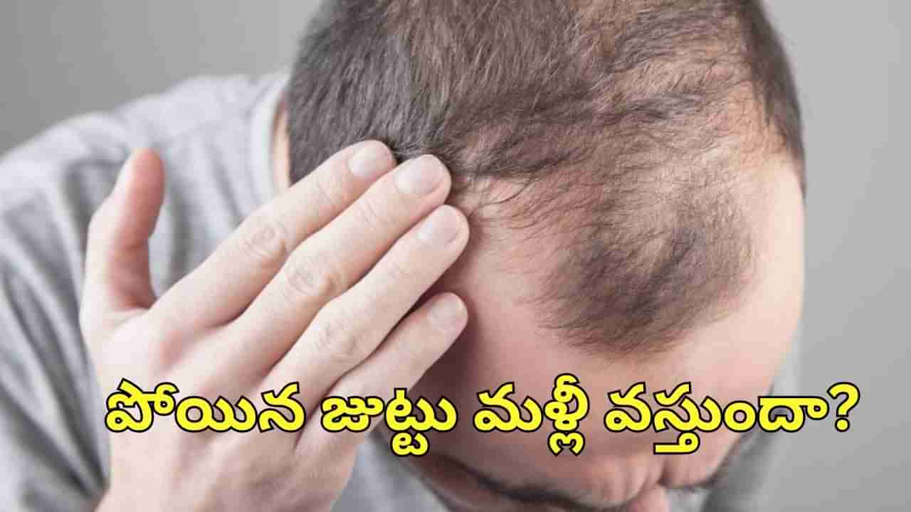 Hair loss: క్యాన్సర్ చికిత్స తర్వాత.. మళ్లీ జుట్టు పెరుగుతుందా..?.. నిపుణులు ఏం చెబుతున్నారు