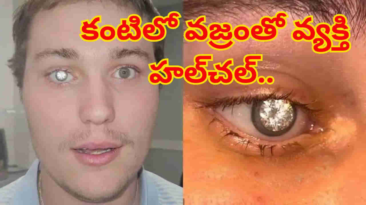 Watch: కంటిలో కోట్ల విలువైన వజ్రం పొదిగిన వ్యక్తి.. షాకింగ్‌ వీడియో వైరల్‌