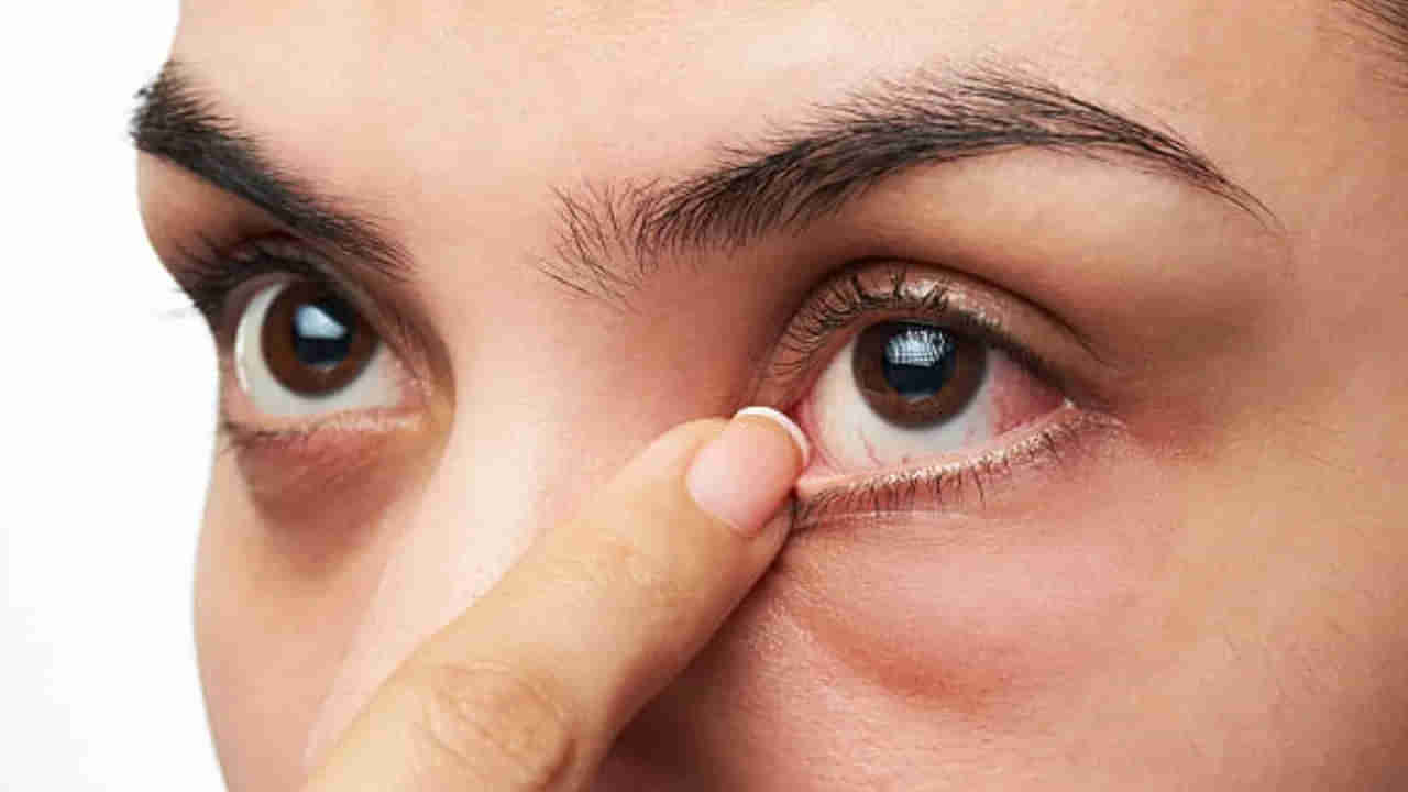 కంటి చూపు మంద‌గించే ముందు కనిపించే లక్షణాలు.. నిర్లక్ష్యం చేశారంటే..