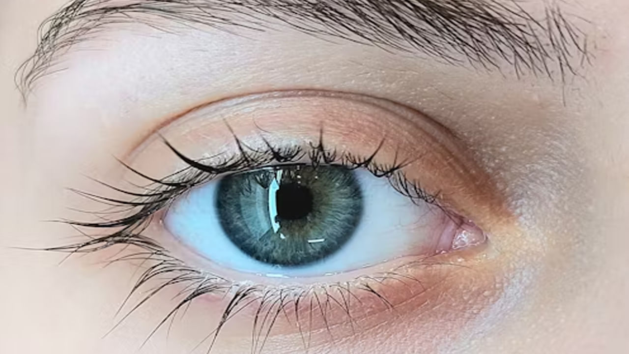 Eye Care Tips: కళ్ళను అలెర్జీ సమస్యల నుంచి రక్షణ కోసం రోజూ ఈ అలవాట్లు దినచర్యలో చేర్చుకోండి..