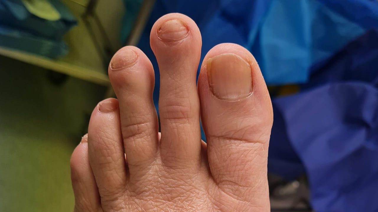 మూడవ వేలు పొడవుగా ఉండేవారు మానసికంగా, శారీరకంగా బలహీనంగా ఉండవచ్చునని నమ్ముతారు. అయితే వారు చాలా చాకచక్యంగా పనులను పూర్తి చేస్తారని కూడా చెబుతారు. వారు వివరాలపై దృష్టి పెడతారు. చిన్న విషయాలను కూడా పరిగణనలోకి తీసుకుంటారు.