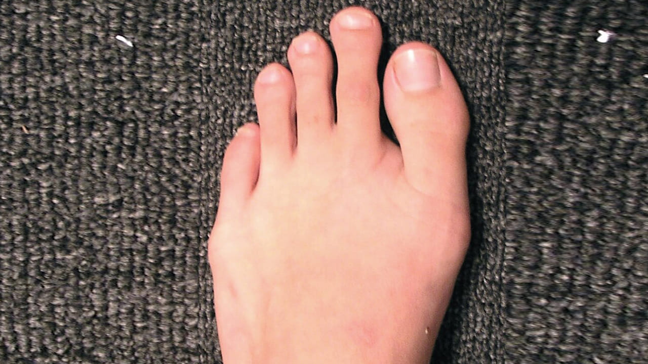 బొటనవేలు కంటే రెండవ వేలు పొడవుగా ఉండే వ్యక్తులు నాయకత్వ లక్షణాలను కలిగి ఉంటారని నమ్ముతారు. అలాంటి వారు ధైర్యవంతులు, నిర్ణయాత్మకత కలిగి ఉంటారు. ఇతరులను ప్రోత్సహించే సామర్థ్యం కలిగి ఉంటారు. వారు సమస్యలను ఎదుర్కొనేటప్పుడు సమర్ధవంతంగా పనిచేస్తారు. వారి లక్ష్యాలను సాధించేందుకు కృషి చేస్తారు.