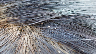 చికెన్ వద్దు బాబు..ఈ ఎముకలు లేని చేప తింటే ఎంతో మేలు!