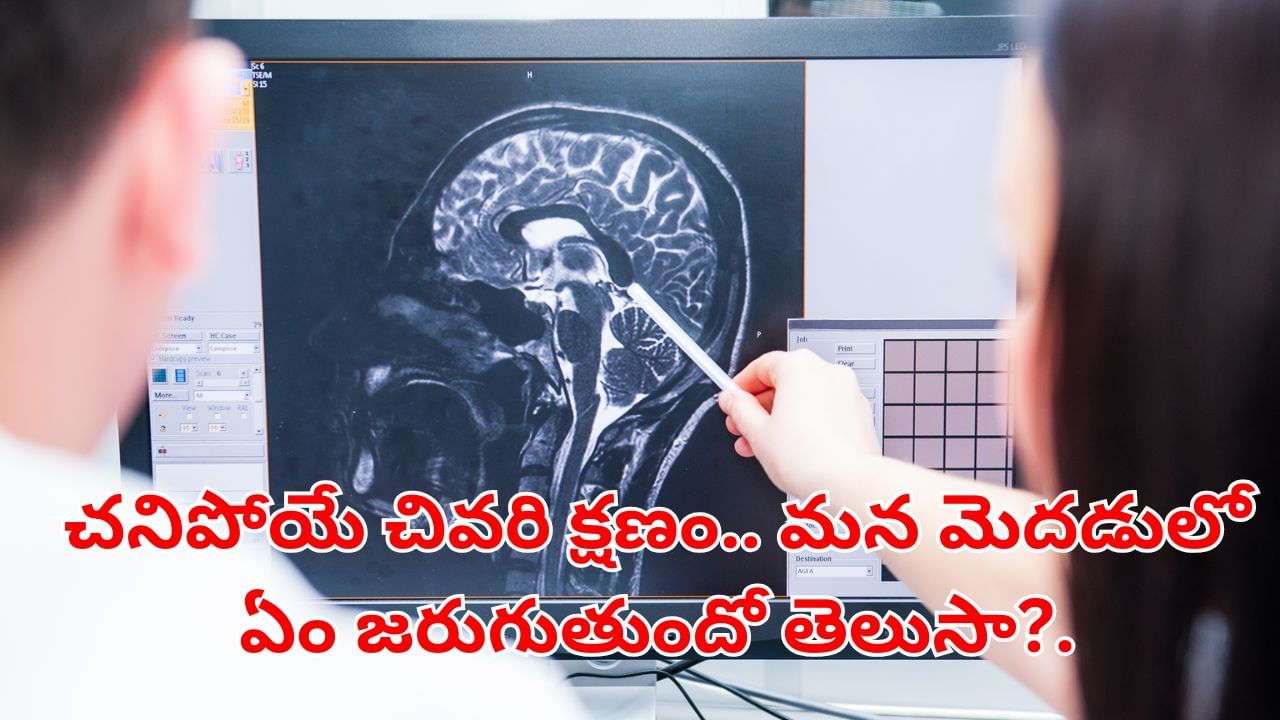 Human Brain: చనిపోయే చివరి క్షణం.. మన మెదడులో ఏం జరుగుతుందో తెలుసా?..అసలు విషయం ఇదేనట..! Human Brain: చనిపోయే చివరి క్షణం.. మన మెదడులో ఏం జరుగుతుందో తెలుసా?..అసలు విషయం ఇదేనట..!