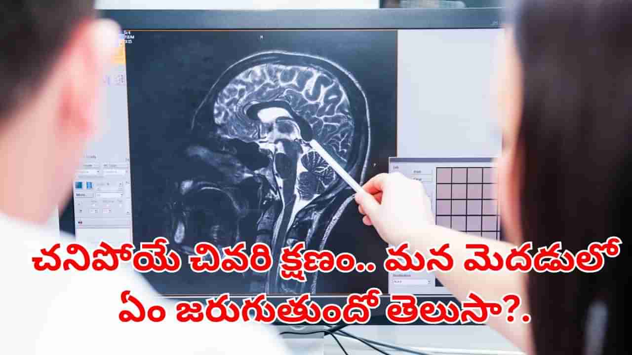 Human Brain: చనిపోయే చివరి క్షణం.. మన మెదడులో ఏం జరుగుతుందో తెలుసా?..అసలు విషయం ఇదేనట..!