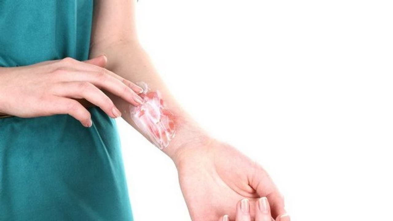 మధుమేహ వ్యాధిగ్రస్తులు, వృద్ధులు, బలహీనమైన రోగనిరోధక శక్తి ఉన్నవారు ఈ విషయంలో మరింత జాగ్రత్తగా ఉండాలి. వారి గాయాలు త్వరగా నయం కావు కాబట్టి, నేలలోని సూక్ష్మజీవులు శరీరంలోకి ప్రవేశించే ప్రమాదం ఎక్కువగా ఉంటుంది. అదనంగా, మట్టిని పూయడం వల్ల గాయంలో చీము ఏర్పడి, ఇన్ఫెక్షన్ అయ్యే ప్రమాదం ఉంటుంది.