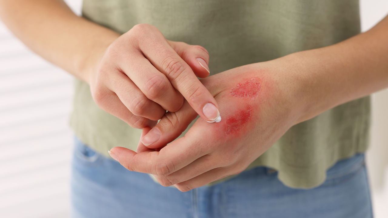 మీరు ఇలాంటి వ్యాధులు బారిన పడకుండా ఉండాలంటే గాయం అయిన వెంటనే మట్టి, పసుపు, నూనె, పాలు లేదా మరే ఇతర పదార్థాన్ని పూయకూడదని వైద్యులు చెబుతున్నారు. గాయం ప్రమాదం వల్ల అయితే, ముందుగా సబ్బుతో శుభ్రం చేయాలి లేదా వెంటనే వైద్యుడిని సంప్రదించాలి. గాయం లోతుగా ఉంటే లేదా ఇనుప వస్తువు వల్ల కలిగి ఉంటే, ఖచ్చితంగా టెటనస్ ఇంజెక్షన్ తీసుకోవాలి