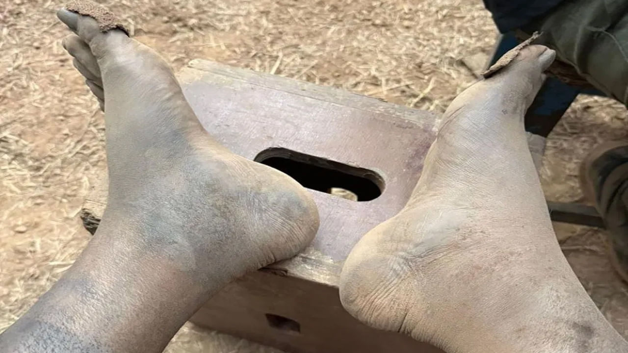 ఇప్పుడు  రిషబ్ శెట్టి తన కాళ్ళ చిత్రాలను ఇన్‌స్టాగ్రామ్‌లో పంచుకున్నాడు. రిషబ్ శెట్టి వాచిన కాళ్ళు ఆ నొప్పి వెనుక ఉన్న కృషి,   క్లైమాక్స్ సీన్ షూటింగ్ కోసం పడిన వ్యధని చెబుతాయి.
