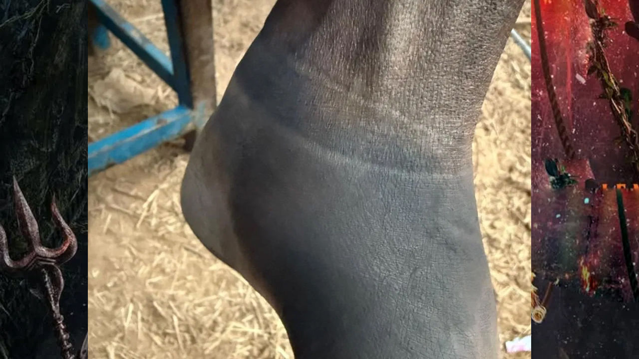 
రిషబ్ షేర్ చేసిన చిత్రాలలో రిషబ్ కాళ్ళు వాచి ఉన్నాయి. బిగుతుగా ఉన్న దుస్తులు, రక్త ప్రసరణ లేకపోవడం వల్ల చర్మం మొద్దుబారినట్లు కనిపిస్తోంది.  
