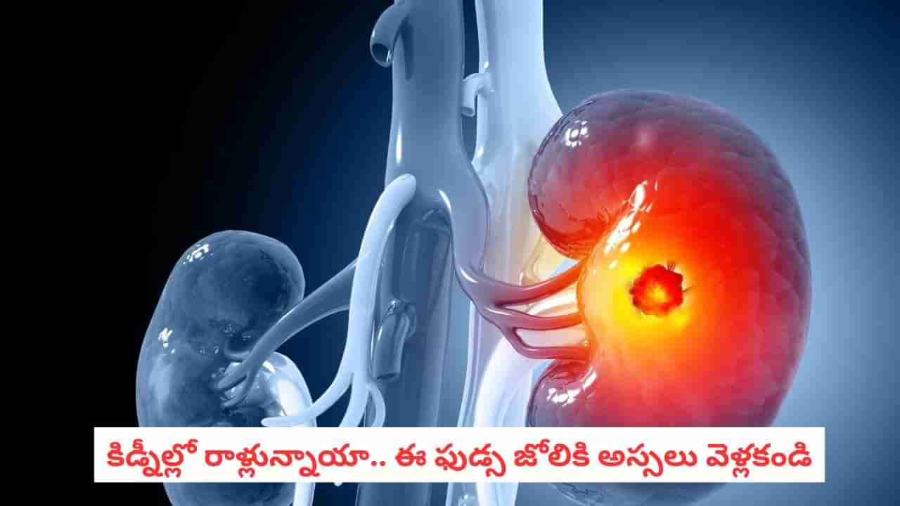 Kidney Health: కిడ్నీలు రాళ్లు మళ్లీ మళ్లీ వస్తున్నాయా.. ఈ ఆహార పదార్థాలే కారణం..