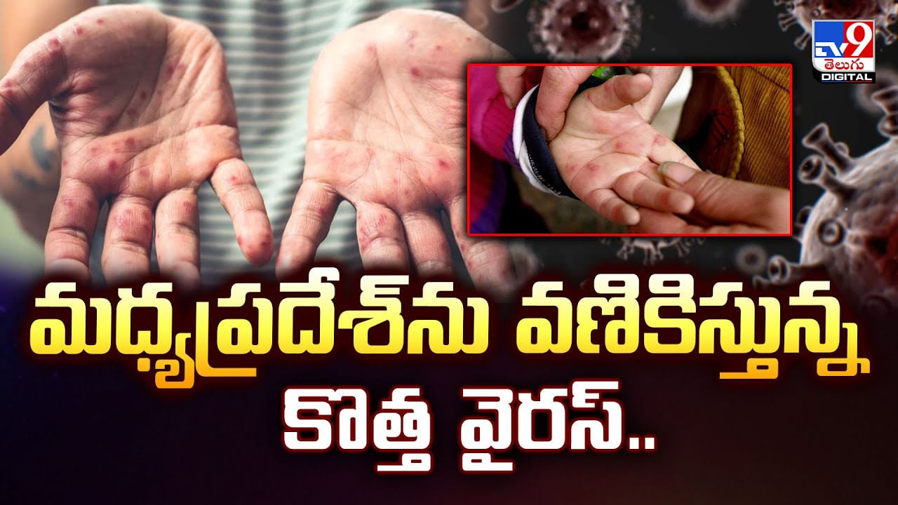 మధ్యప్రదేశ్‌ను వణికిస్తున్న కొత్త వైరస్‌ వీడియో