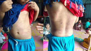 Supreme Court: తెలంగాణ బీసీ రిజర్వేషన్‌పై స్టే కు సుప్రీంకోర్టు నో.. పిటీషన్‌ కొట్టివేత!