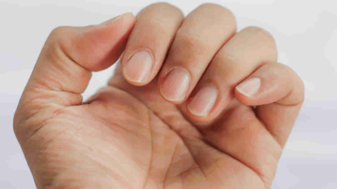 Nails Health: మీ గోళ్లు ఇలా మారుతున్నాయా? ఈ వ్యాధులకు సంకేతాలు..!