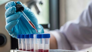 ఆరోగ్యానికి మంచిదని పసుపు తెగ ఉపయోగిస్తున్నారా.. కాలేయానికి ముప్పు.. రోజూ ఎంత వాడాలో తెలుసా..