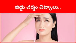 గంధం ఆ చర్మ సమస్యలకు వరం.. అప్లై చేస్తే ఫేస్ తళ తళ..