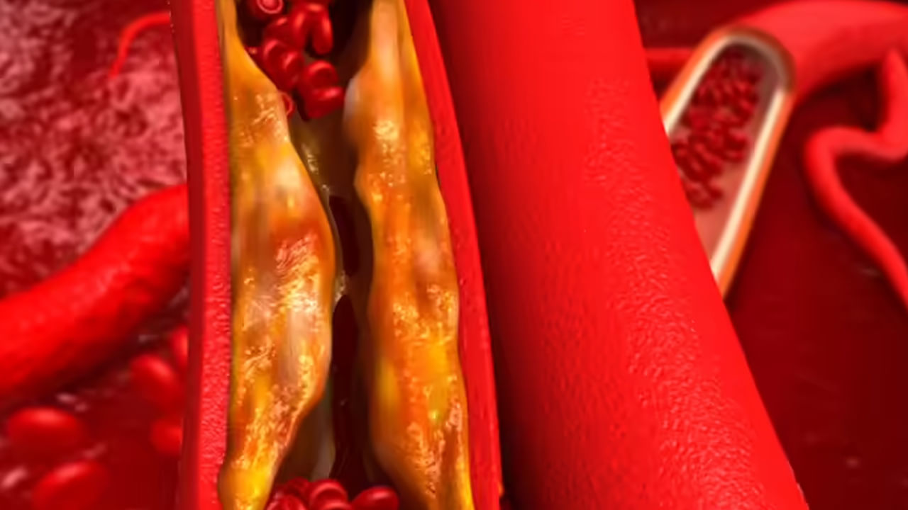 సోలనిన్, కోకోనిన్ అనేవి బంగాళాదుంపలలో కనిపించే రెండు గ్లైకోఅల్కలాయిడ్ సమ్మేళనాలు. బంగాళాదుంపలు మొలకెత్తడం ప్రారంభించినప్పుడు వాటి సాంద్రతలు వేగంగా పెరుగుతాయి. సైన్స్ డైరెక్ట్ పరిశోధన ప్రకారం, అవి తక్కువ మొత్తంలో ప్రయోజనకరంగా ఉన్నప్పటికీ, అధిక మొత్తంలో విషపూరితంగా మారే అవకాశం ఉంటుందని నిపుణులు చెబుతున్నారు. 