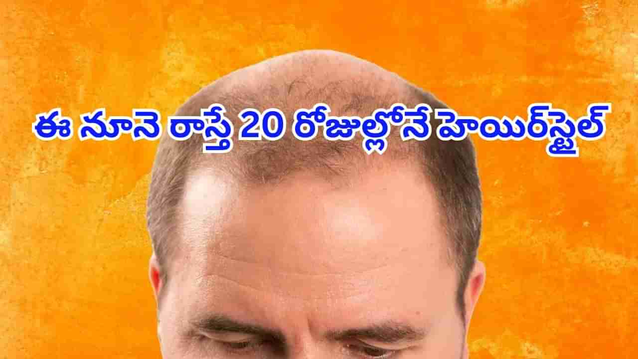 బట్టతల వారికి సూపర్‌ గుడ్‌న్యూస్‌..! కేవలం 20 రోజుల్లోనే జుట్టు పెంచే సీరం వచ్చేసిందోచ్..