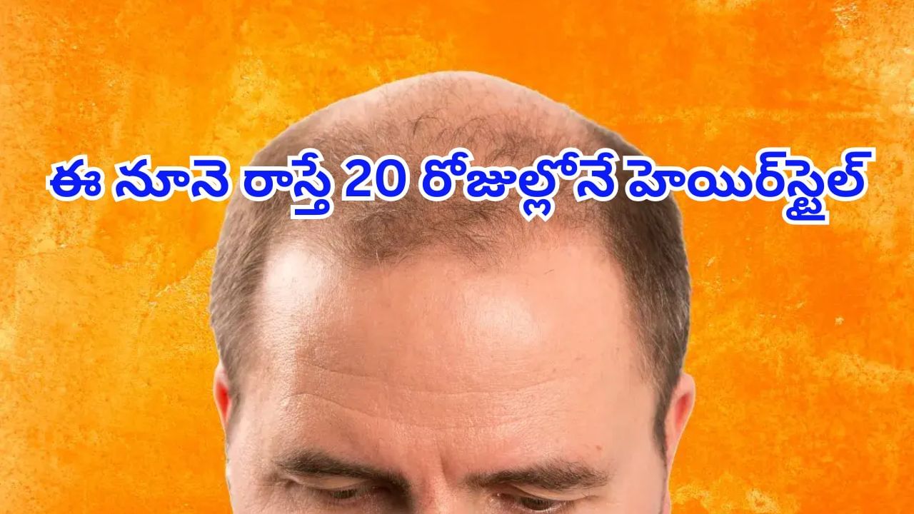 బట్టతల వారికి సూపర్‌ గుడ్‌న్యూస్‌..! కేవలం 20 రోజుల్లోనే జుట్టు పెంచే సీరం వచ్చేసిందోచ్..