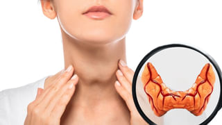 Heart Attack: ఈ 5 ఆహారాలు తినకపోతే చాలు.. గుండెపోటు రమ్మన్నా రాదు..