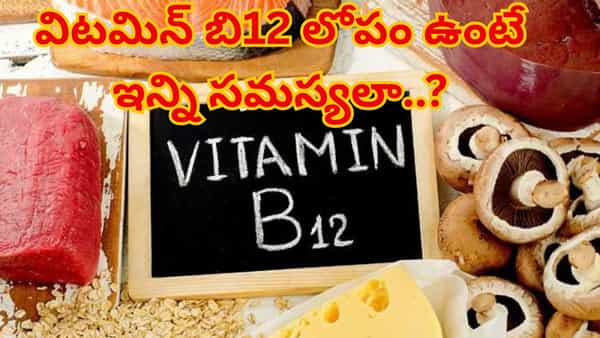 Vitamin B12 deficiency: ఇలాంటి లక్షణాలు ఉంటే విటమిన్ బీ 12 లోపం ఉన్నట్టే.. తస్మాత్ జాగ్రత్త!