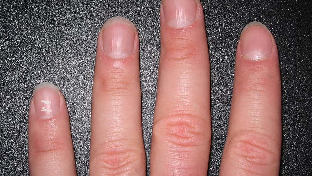 కుడి చేతి చిన్న గోరుపై మచ్చలు కోరికలు నెరవేరడాన్ని సూచిస్తాయి. అంటే, ఇది చాలా కాలంగా ఉన్న కోరికలు నెరవేరడానికి సంకేతంగా పరిగణించబడుతుంది. ఉదాహరణకు, ప్రభుత్వ ఉద్యోగం కోసం ఆశిస్తున్న వ్యక్తికి ప్రభుత్వ ఉద్యోగం లభిస్తుంది. ప్రేమ జీవితం విజయవంతమవుతుంది. జీవితం కోరుకున్న విధంగా సంతోషంగా ఉంటుంది. సాముద్రిక శాస్త్రం ప్రకారం ఎడమ చిన్న వేలుగోలుపై మచ్చలు పురోగతిని సూచిస్తాయి. పురోగతి అంటే వృత్తి జీవితంలో మాత్రమే కాదు, వైవాహిక జీవితంలో, వ్యక్తిగత జీవితంలో కూడా పురోగతిని సూచిస్తుంది.