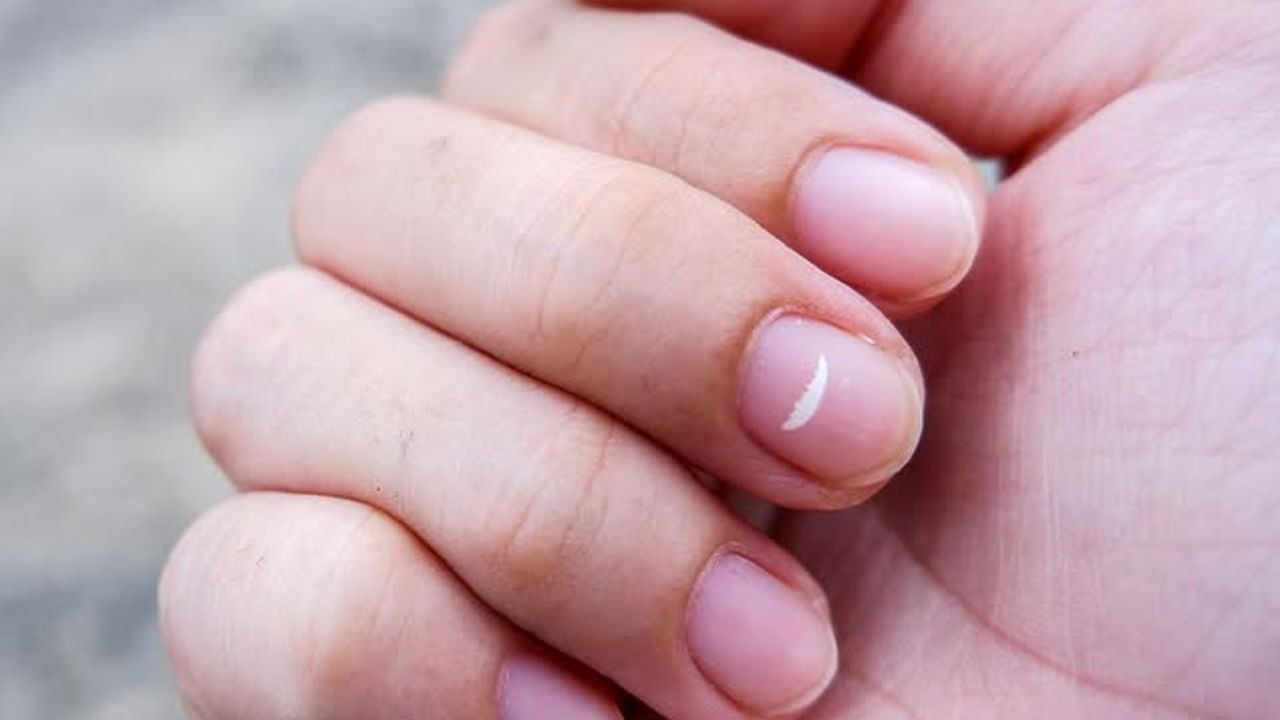 మధ్య వేలు గోరుపై తెల్లటి మచ్చ ఉండటం మన కెరీర్ ప్రభావానికి సంబంధించినదని చెబుతారు. ఇది భవిష్యత్తు అవకాశాలను సూచించే సంకేతంగా కూడా పరిగణించబడుతుంది. ఈ విధంగా, మీ కుడి చేతి మధ్య వేలు గోరుపై మచ్చలు ఉంటే, మీరు త్వరలో ఉన్నత స్థానాన్ని పొందుతారని మీరు అర్థం చేసుకోవచ్చు. కెరీర్ పెరుగుతుంది. వ్యాపారం అభివృద్ధి చెందుతుంది. ఆదాయం పెరుగుతుంది. సమాజంలో మంచి పేరు, ఉన్నత హోదా పొందే అవకాశం ఉంది. అదే సమయంలో, మీ ఎడమ చేతి మధ్య వేలు గోరుపై మచ్చలు ఉంటే, వివాహ విషయాలు విజయవంతమవుతాయి. ప్రేమ జీవితం విజయవంతమవుతుంది. ప్రేమ, వివాహంలో ఎదురయ్యే అన్ని సమస్యలు తొలగిపోతాయని నిపుణులు సూచిస్తున్నారు!