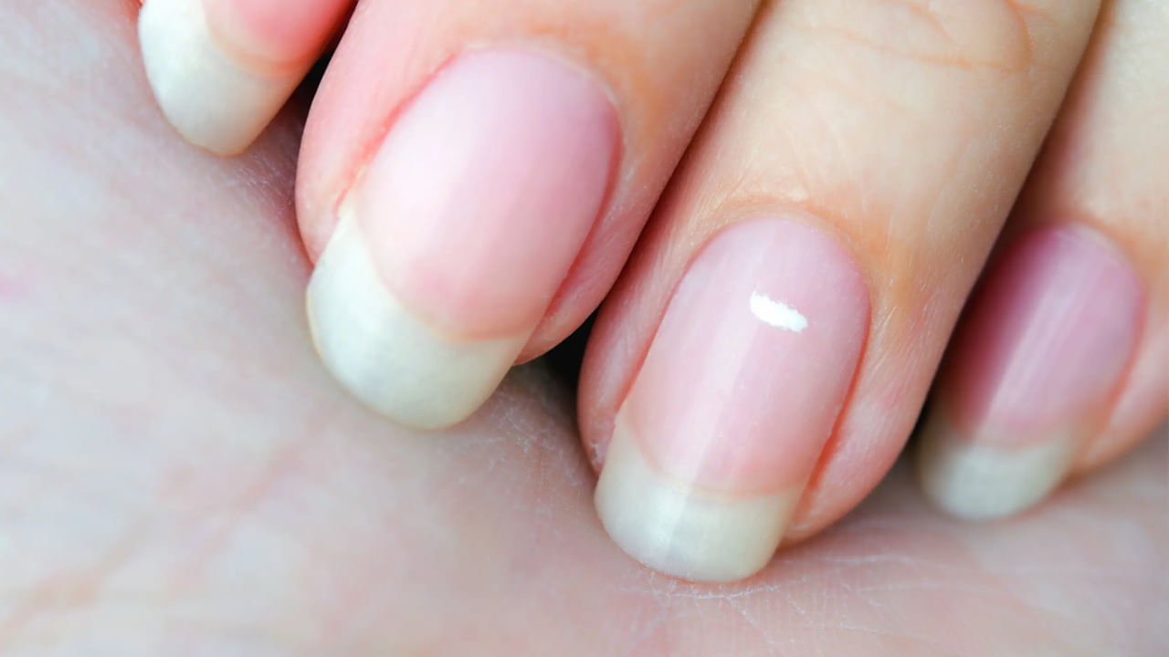 కుడి చేతి ఉంగరపు వేలు గోరుపై తెల్లటి మచ్చ సానుకూల శక్తిని తెస్తుందని చెబుతారు. ఇది కెరీర్‌లో కొత్త అవకాశాలను తెస్తుందని కూడా భావిస్తారు. ముఖ్యంగా కళా రంగంలోని నగరాలు తమ రంగంలో రాణించడానికి అనేక అవకాశాలను కలిగి ఉంటాయని, ఈ అవకాశాలను సరిగ్గా ఉపయోగించుకుంటే, జీవితం మెరుగ్గా ఉంటుందని సముద్రిక శాస్త్రం పేర్కొంది. మీ ఎడమ చేతి ఉంగరపు వేలుగోలుపై తెల్లని మచ్చలు ఉంటే, అది ఆకస్మిక ఆదాయాన్ని తెస్తుందని నమ్ముతారు. అంటే, ఇది లాటరీ, స్టాక్ మార్కెట్ పెట్టుబడుల ద్వారా ఆదాయాన్ని తెస్తుందని నమ్ముతారు!