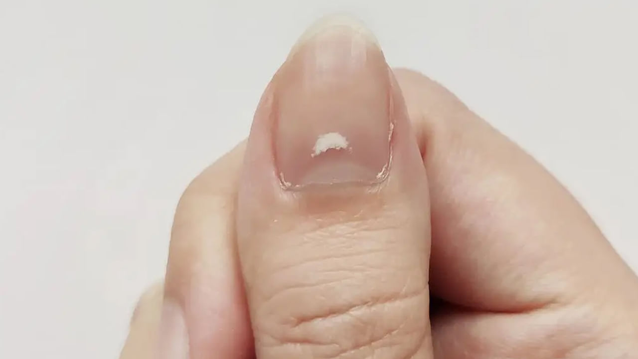 కుడి బొటనవేలు గోరుపై ఉన్న మచ్చలు శాశ్వత సంబంధానికి సంకేతం. అంటే, మీరు మీ జీవితంలో చాలా ముఖ్యమైన వ్యక్తిని కలవబోతున్నారనడానికి ఈ గుర్తును సంకేతంగా తీసుకోవచ్చు. ఎవరైనా మీ సన్నిహిత స్నేహితుడు, జీవిత భాగస్వామి లేదా మీ జీవితాంతం మీతో ప్రయాణించడానికి వేచి ఉన్న ఆత్మీయుడు కావచ్చు . ఎడమ చేతి బొటనవేలు గోరుపై తెల్లని మచ్చలు ఉండటం ఆశయ మార్గంలో విజయం సాధించడాన్ని సూచిస్తుంది. అంటే, ఈ గుర్తులను మీ జీవిత లక్ష్యాన్ని సాధించే మార్గాన్ని కనుగొనే సంకేతంగా నిపుణులు సూచిస్తున్నారు!