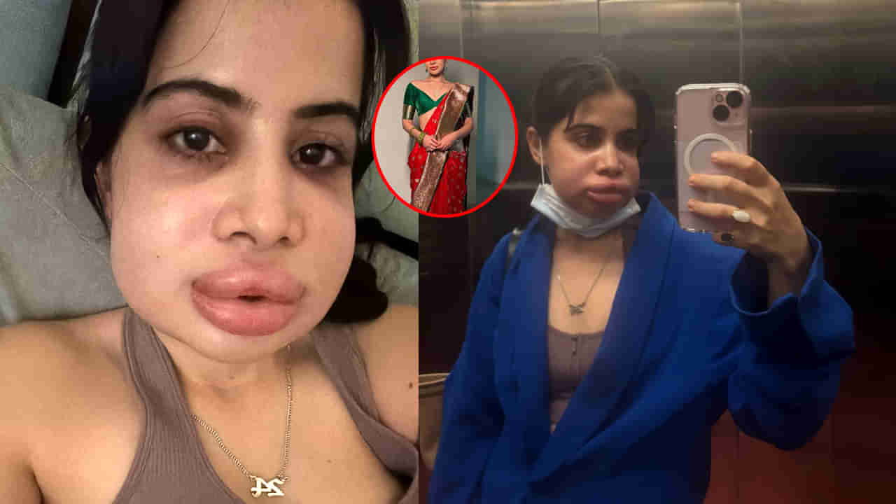 అందంకోసం ఆశపడింది.. కట్ చేస్తే సర్జరీ తర్వాత ఇలా..! గుర్తుపట్టలేనంతగా మారిపోయిన హీరోయిన్