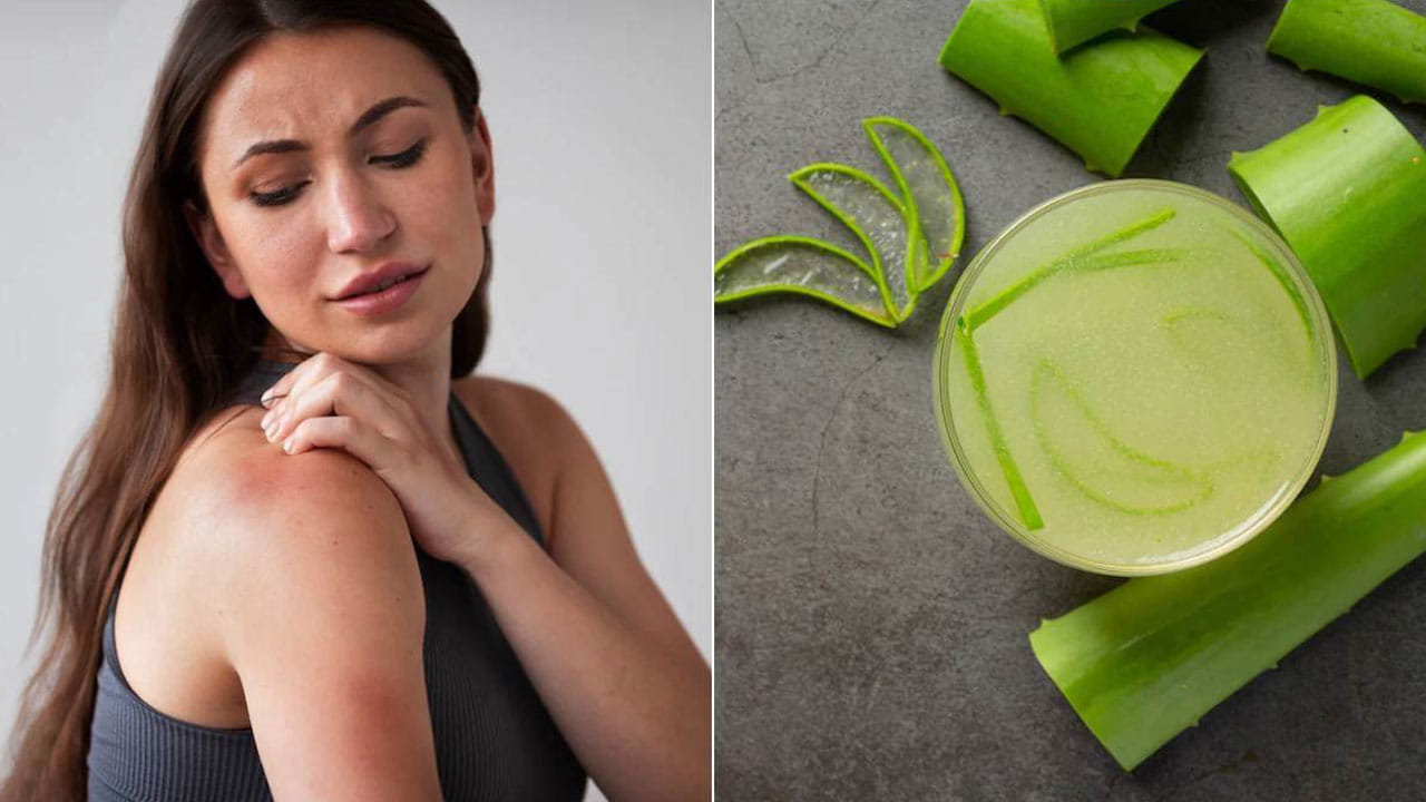 కలబంద అధిక మొత్తంలో ఉపయోగించడం వల్ల అలెర్జీ ప్రమాదాన్ని పెంచుతుంది. కలబంద కొమ్మ నుండి నేరుగా జెల్‌ను తీసి అప్లై చేస్తే, అది అలెర్జీలకు కారణం కావచ్చు. దీనివల్ల చర్మంపై అలర్జీ, కళ్లు ఎర్రబడడం, దద్దుర్లు, మంట, దురద వంటి సమస్యలు వస్తాయి.
